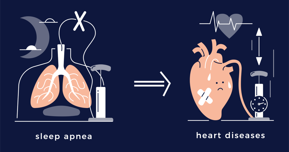 Illustration showing sleep apnea leading to heart disease