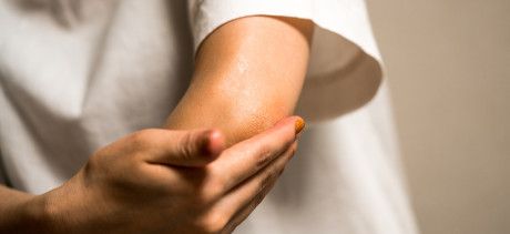 person applying lotion to their elbow